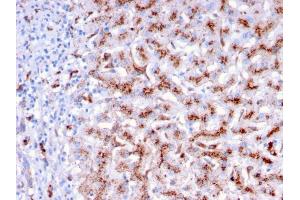 Immunohistochemistry (IHC) image for anti-Cathepsin D (CTSD) (AA 104-250) antibody (ABIN6939218)