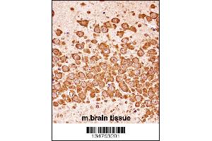 Mouse Dapk3 Antibody immunohistochemistry analysis in formalin fixed and paraffin embedded mouse brain tissue followed by peroxidase conjugation of the secondary antibody and DAB staining. (DAPK3 antibody  (AA 255-282))