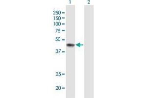 Western Blot analysis of ERCC8 expression in transfected 293T cell line by ERCC8 MaxPab polyclonal antibody. (ERCC8 antibody  (AA 1-396))