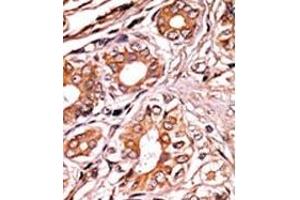 Image no. 2 for anti-Retinoblastoma 1 (RB1) (pSer249) antibody (ABIN358210) (Retinoblastoma 1 antibody  (pSer249))