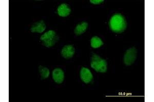 Immunofluorescence of purified MaxPab antibody to ITPK1 on HeLa cell. (ITPK1 antibody  (AA 1-314))