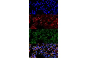 Immunocytochemistry/Immunofluorescence analysis using Mouse Anti-Malondialdehyde Monoclonal Antibody, Clone 6H6 .