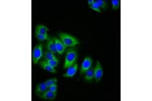 Immunofluorescence staining of HepG2 cells with ABIN7157699 at 1:200, counter-stained with DAPI. (KRIT1 antibody  (AA 471-585))