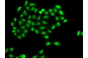 Immunofluorescence analysis of  cells using PHF11 antibody (ABIN6128437, ABIN6145533, ABIN6145535 and ABIN6217420). (PHF11 antibody  (AA 1-292))