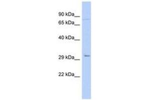 Image no. 1 for anti-Paired-Like Homeodomain 2 (PITX2) (N-Term) antibody (ABIN6742271) (PITX2 antibody  (N-Term))