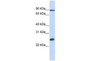 WB Suggested Anti-RBPMS Antibody Titration:  0. (RBPMS antibody  (Middle Region))