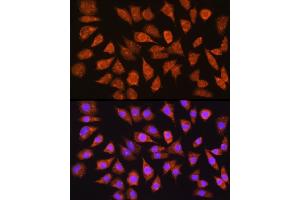 Immunofluorescence analysis of L929 cells using IMPDH1 Rabbit pAb (ABIN6133190, ABIN6142433, ABIN6142434 and ABIN6225023) at dilution of 1:100 (40x lens). (IMPDH1 antibody  (AA 434-563))