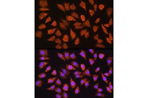 Immunofluorescence analysis of L929 cells using IMPDH1 Rabbit pAb (ABIN6133190, ABIN6142433, ABIN6142434 and ABIN6225023) at dilution of 1:100 (40x lens). (IMPDH1 antibody  (AA 434-563))