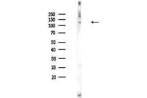 anti-SIN3 Transcription Regulator Homolog B (SIN3B) (Internal Region) antibody