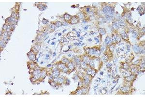 Immunohistochemistry (Paraffin-embedded Sections) (IHC (p)) image for anti-Histidine Ammonia-Lyase (HAL) antibody (ABIN7256538)