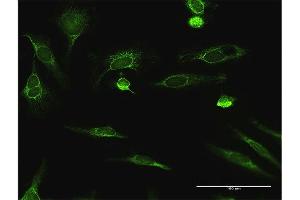 Immunofluorescence of purified MaxPab antibody to ECHS1 on HeLa cell. (ECHS1 antibody  (AA 1-290))