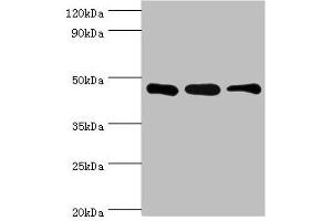 Western blot All lanes: SUGCT antibody at 16 μg/mL Lane 1: Mouse skeletal muscle tissue Lane 2: Mouse liver tissue Lane 3: Mouse kidney tissue Secondary Goat polyclonal to rabbit IgG at 1/10000 dilution Predicted band size: 49, 48, 52, 44 kDa Observed band size: 42 kDa (SUGCT antibody  (AA 1-250))