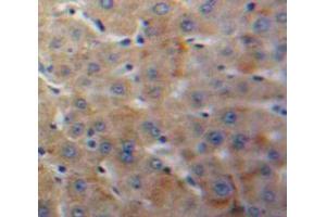 IHC-P analysis of Liver tissue, with DAB staining. (IGFBP4 antibody  (AA 22-258))
