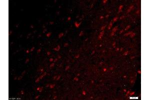 Paraformaldehyde-fixed, paraffin embedded rat brain tissue, Antigen retrieval by boiling in sodium citrate buffer(pH6) for 15min, Block endogenous peroxidase by 3% hydrogen peroxide for 30 minutes, Blocking buffer (normal goat serum) at 37°C for 20min, Antibody incubation with Rabbit Anti-UBE2Q1 Polyclonal Antibody, Unconjugated  at 1:500 overnight at 4°C, followed by a conjugated secondary and DAPI staining (UBE2Q1 antibody  (AA 321-422))