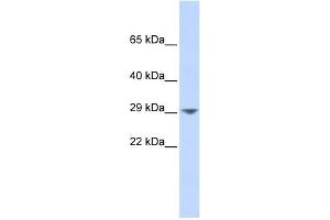 KCNN2 antibody used at 1 ug/ml to detect target protein. (KCNN2 antibody  (Middle Region))