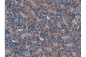 Immunohistochemistry (IHC) image for anti-Transcription Factor A, Mitochondrial (TFAM) (AA 43-243) antibody (ABIN7438793)