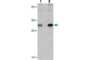 Western blot analysis of PTRF in human spleen tissue with PTRF polyclonal antibody  at (lane 1) 0.