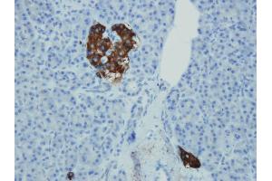 Immunohistochemistry (IHC) image for anti-Synaptophysin (SYP) (AA 293-310), (C-Term) antibody (ABIN7598775) (Synaptophysin antibody  (C-Term))