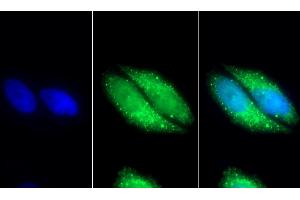 Detection of MDH2 in Human HepG2 cell using Polyclonal Antibody to Malate Dehydrogenase 2 (MDH2) (MDH2 antibody  (AA 25-338))