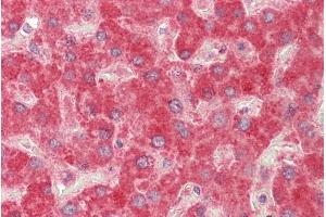 ABIN1590061 (5µg/ml) staining of paraffin embedded Human Liver. (MMP14 antibody  (Internal Region))