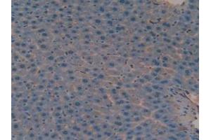 Figure. (Versican antibody  (AA 3058-3299))