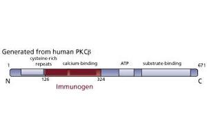 Image no. 2 for anti-Protein Kinase C, beta (PRKCB) (AA 126-324) antibody (ABIN967769) (PKC beta antibody  (AA 126-324))