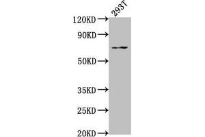 Western Blot Positive WB detected in: 293T whole cell lysate All lanes: PXN antibody at 1:2000 Secondary Goat polyclonal to rabbit IgG at 1/50000 dilution Predicted band size: 65, 61, 67, 47 kDa Observed band size: 65 kDa (Paxillin antibody  (AA 28-45))
