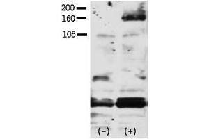 Image no. 1 for anti-V-Erb-A erythroblastic Leukemia Viral Oncogene Homolog 4 (Avian) (ERBB4) (pTyr1188) antibody (ABIN358140) (ERBB4 antibody  (pTyr1188))