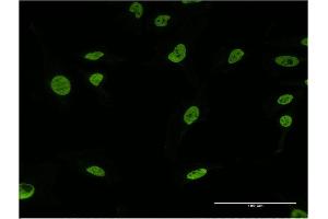 Immunofluorescence (IF) image for anti-U2 Small Nuclear RNA Auxiliary Factor 2 (U2AF59) (AA 141-240) antibody (ABIN949064)