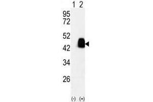 Image no. 2 for anti-Pyruvate Dehydrogenase Complex, Component X (PDHX) antibody (ABIN357415) (PDHX antibody)