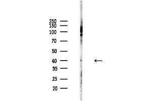 anti-Interleukin 1 Receptor, Type II (IL1R2) (C-Term) antibody