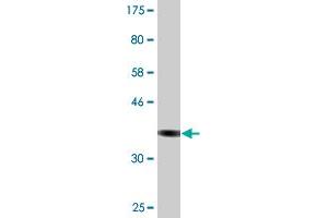 Western Blot detection against Immunogen (36. (CSAD antibody  (AA 1-98))