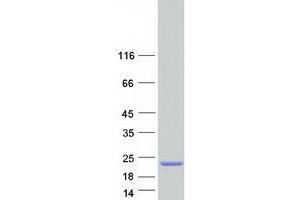 Validation with Western Blot