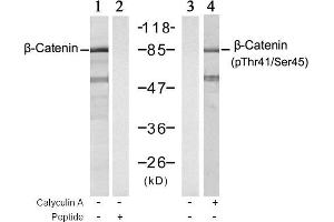 Image no. 1 for anti-Catenin (Cadherin-Associated Protein), beta 1, 88kDa (CTNNB1) (pSer45), (pThr41) antibody (ABIN196815) (CTNNB1 antibody  (pSer45, pThr41))