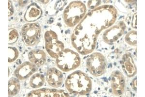 Immunohistochemistry (IHC) image for anti-Aldehyde Dehydrogenase 1 Family, Member A2 (ALDH1A2) (AA 1-422) antibody (ABIN7435901)