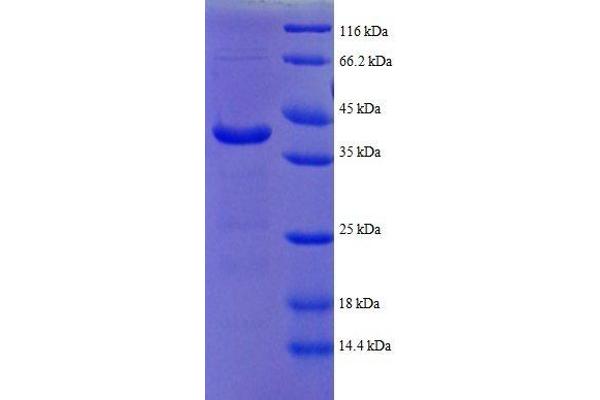 ATP5F1D Protein (AA 43-161, partial) (GST tag)