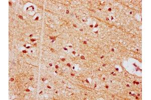 IHC image of ABIN7154356 diluted at 1:500 and staining in paraffin-embedded human brain tissue performed on a Leica BondTM system. (PIGT antibody  (AA 402-562))