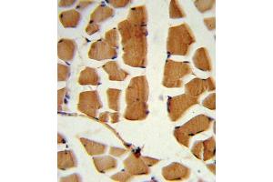 Immunohistochemistry (IHC) image for anti-BMI1 Polycomb Ring Finger Oncogene (BMI1) antibody (ABIN3001536)
