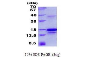 Image no. 1 for Platelet Derived Growth Factor D (PDGFD) protein (His tag) (ABIN1098679) (PDGFD Protein (His tag))