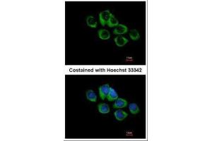 ICC/IF Image Immunofluorescence analysis of methanol-fixed A431, using TRHR, antibody at 1:500 dilution. (TRHR antibody  (C-Term))