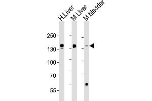 Western blot analysis of lysates from human Liver, mouse Liver, mouse bladder tissue (from left to right), using FGA Antibody (N-term) (ABIN1538750 and ABIN2843856). (FGA antibody  (N-Term))