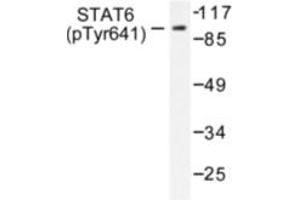 Image no. 1 for anti-Signal Transducer and Activator of Transcription 6, Interleukin-4 Induced (STAT6) (pTyr641) antibody (ABIN318133) (STAT6 antibody  (pTyr641))