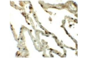 Immunohistochemistry of Translin in Human lung tissue with Translin antibody at 5 µg/ml. (Translin antibody  (C-Term))