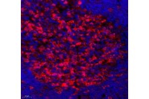 Immunofluorescence (Paraffin-embedded Sections) (IF (p)) image for anti-Stem-Loop Binding Protein (SLBP) antibody (ABIN7075733)
