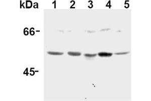 Western Blotting (WB) image for anti-Caspase 12 (Gene/pseudogene) (CASP12) (AA 95-318), (N-Term) antibody (ABIN567795) (Caspase 12 antibody  (N-Term))