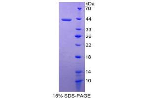 SDS-PAGE (SDS) image for Melanoma Inhibitory Activity (MIA) (AA 36-127) protein (His tag,GST tag) (ABIN2123253) (MIA Protein (AA 36-127) (His tag,GST tag))