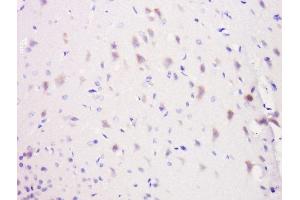 Paraformaldehyde-fixed, paraffin embedded rat brain, Antigen retrieval by boiling in sodium citrate buffer (pH6) for 15min, Block endogenous peroxidase by 3% hydrogen peroxide for 30 minutes, Blocking buffer (normal goat serum) at 37°C for 20min, Antibody incubation with Rabbit Anti-NeuroD1 Polyclonal Antibody, Unconjugated  at 1:500 overnight at 4°C, followed by a conjugated secondary for 90 minutes and DAB staining. (NEUROD1 antibody  (AA 21-120))