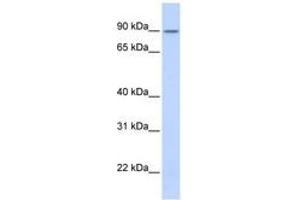 Image no. 1 for anti-Zinc Finger Protein 408 (ZNF408) (AA 576-625) antibody (ABIN6740345) (ZNF408 antibody  (AA 576-625))