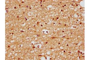 IHC image of ABIN7165514 diluted at 1:200 and staining in paraffin-embedded human brain tissue performed on a Leica BondTM system. (BRINP2 antibody  (AA 98-199))