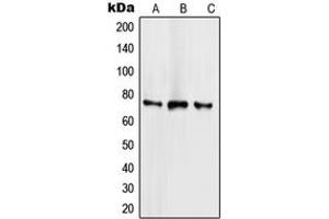 Western blot analysis of SCML2 expression in HeLa (A), NCIH460 (B), Jurkat (C) whole cell lysates.